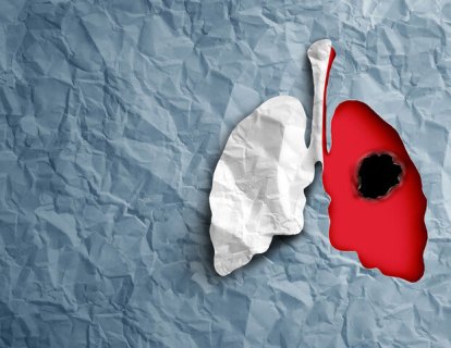 13 mesleki karsinojen (kanser yapıcı) ve mesleksel kanserler