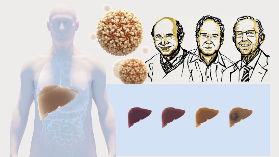 2020 Nobel Fizyoloji veya Tıp Ödülü hepatit c virüs keşfi