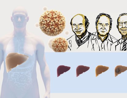 2020 Nobel Fizyoloji veya Tıp Ödülü, Hepatit C virüsü keşfine verildi