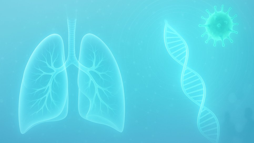 ASCO Living Guide for Stage 4 Non-Mutational Non-Small Cell Lung Cancer