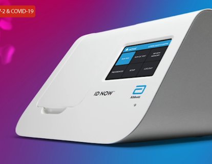 5 Dakikada Yeni Koronavirüsü Saptayabilen Test FDA Onayı Aldı