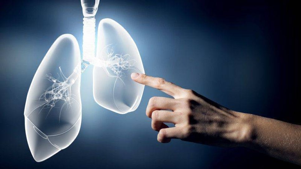 Akciğer kanserinin küçük hücreli olmayan türünün tedavisinde yeni bir ilaç yaşam süresini uzattığı için FDA onayı aldı: Osimertinib