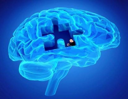 Alzheimer’da Bilişsel Bozukluklarda Kullanılan Donepezil, Beyin Radyoterapisi Alan Hastalarda da Faydalı Mı?