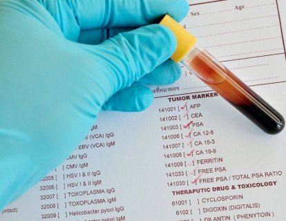 Biyomarker, Tümör Markerı, Biyobelirteç Nedir? Kanserde Ne Gibi Rolü Vardır?