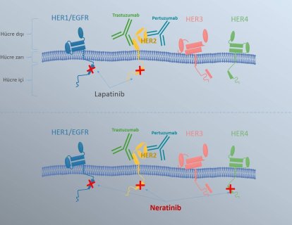 Erken Evre Meme Kanseri Tedavisinde Yeni Bir İlaç: Neratinib