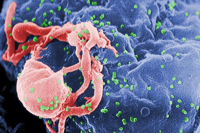 HIV aids 640505