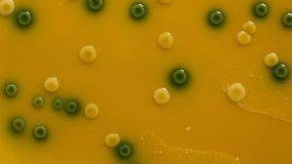 Listeria Bakterisi ile Pankreas Kanserinde Radyoizotop Tedavisi