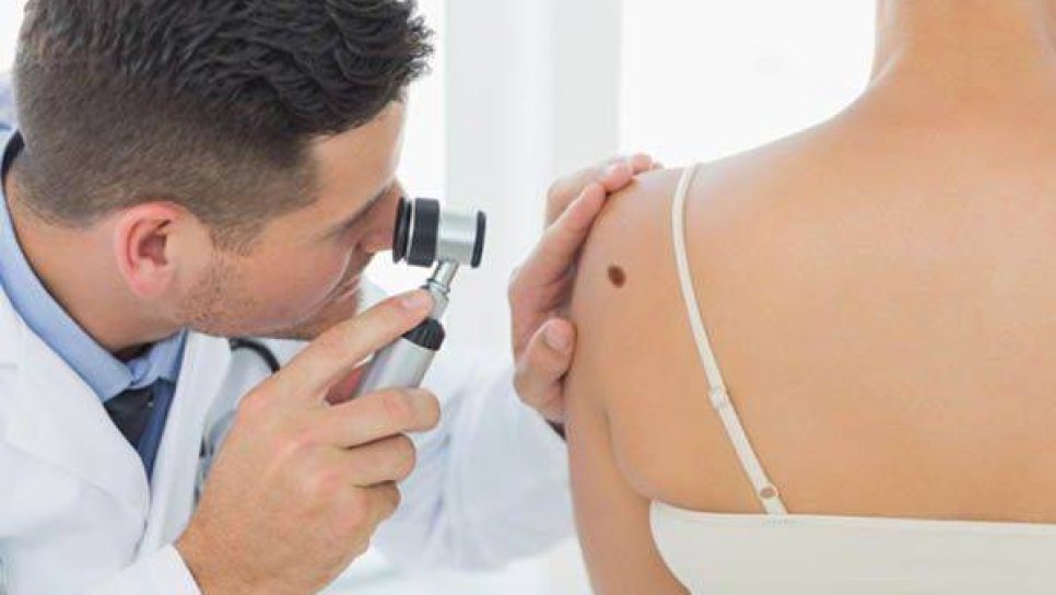 İleri Evre Cilt Kanseri (Melanom) Tedavisinde Yeni Bir İlaç; Nivolumab