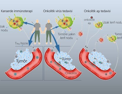 İmmunoterapi ve ötesi: kanser aşısı