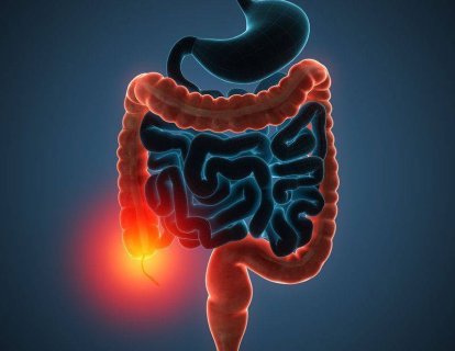 Kalın bağırsak - kolorektal kanser için kolonoskopi ile tarama