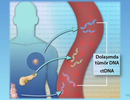 Kan Tahlilinde Kanser Belirtisi: Tümör DNA Parçaları (ctDNA). Yazı Dizisi-3