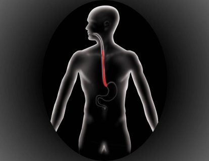 Kanser Türlerine Göre Tanı ve Tedavi Bölümüne Özofagus (Yemek Borusu) Kanseri Bölümü Eklendi