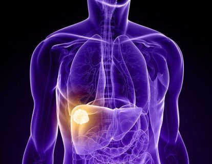 Karaciğer kanseri tedavisi için regorafenib (Stivarga) FDA onayı aldı