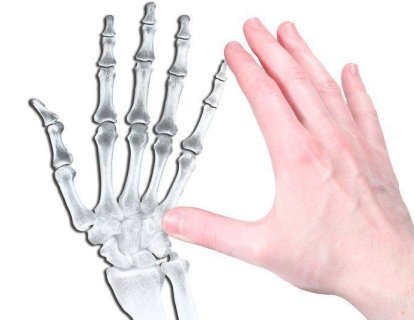 Kondrom nedir? Yumuşak doku kondromu belirtileri ve tedavisi