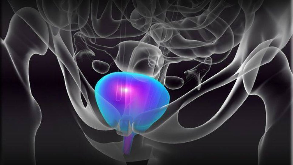 Mesane Kanserinin Tedavisi İçin Nivolumab Adlı Yeni Nesil İmmünoterapiye FDA Onay Verdi