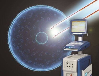 Metastatik olmayan, ameliyat edilemez (bölgesel ilerlemiş) pankreas kanserinde kombine tedavi yöntemi: kemoterapi, radyoterapi, cerrahi ve Nanoknife