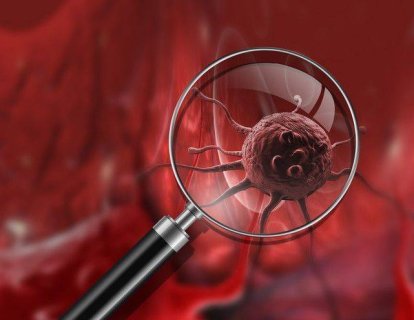 Metastazın öncüsü: kanda dolaşan tümör hücreleri (CTC), kanser tedavisinde yeni bir kilometre taşı