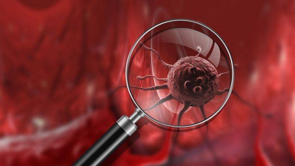 Metastazın öncüsü: kanda dolaşan tümör hücreleri (CTC), kanser tedavisinde yeni bir kilometre taşı