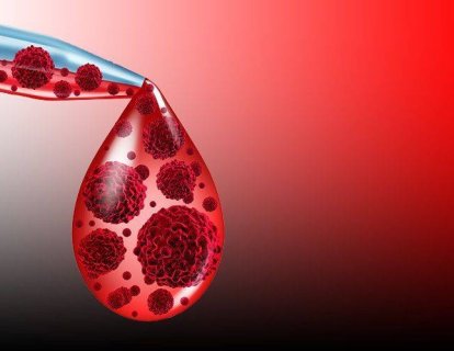 Multiple myelomda otolog kök hücre nakli sonrası lenalidomid yaşam sürelerini uzatıyor