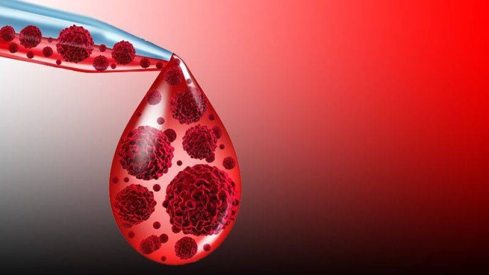 Multiple myelomda otolog kök hücre nakli sonrası lenalidomid yaşam sürelerini uzatıyor