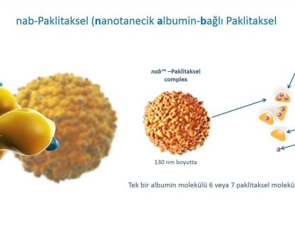Radyoduyarlaştırıcılar, Nanoterapötikler, Nanotanecik Albumin-Bağlı Paklitaksel