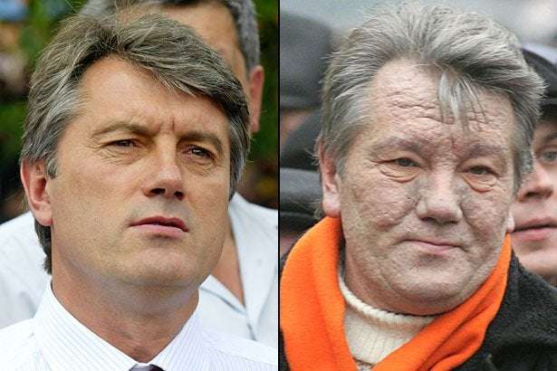 Viktor Yuscenko dioksin akut zehirlenme 879042