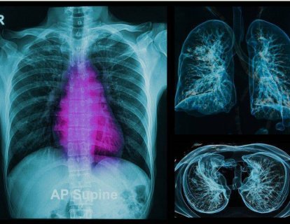 Yeni bir organ bulundu: İnterstisyum, ama bu tahmin ettiğiniz şey olmayabilir