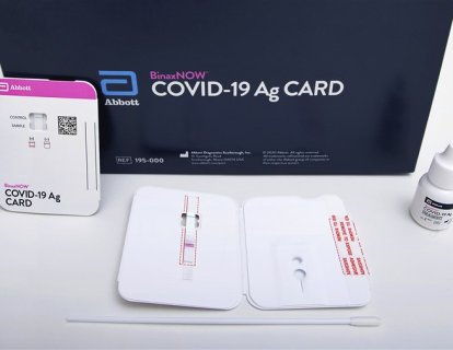 Sonuçların TEST KARTI ile doğrudan okunabildiği ilk koronavirüs testi FDA onayı aldı