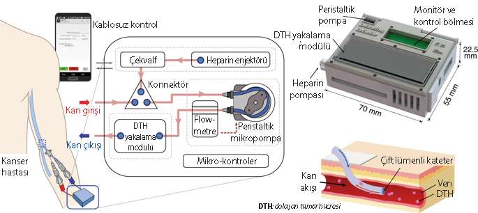 aferez damar icinde kateteri bulunan likit biyopsi cipi 198258