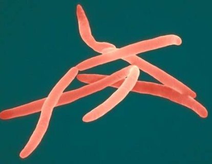 Ağızdaki bakterilerin nasıl agresif kalın bağırsak kanserine neden olduğu keşfedildi