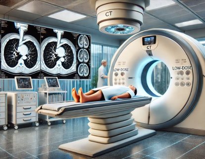 Akciğer Kanseri Erken Tanısı için BT, Kalp Damar Tıkanıklığını Tespit Etmede de Yararlı
