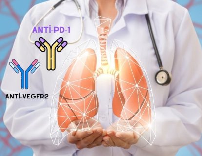 Akciğer Kanserinde Önemli Gelişme: 2. Basamak Tedavide Ramucirumab artı Pembrolizumab