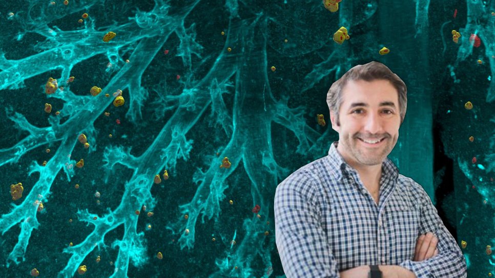 Ali Ertürk ve Ekibinin Yapay Zeka ile Tüm Vücutta Kanser Metastazı ve İlaç Hedeflerini Açığa Çıkaran Çalışması
