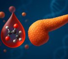 Alcohol and Pancreatic Cancer: The Strongest Evidence Has Arrived!