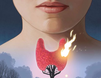 Anaplastik Tiroid Kanseri için Lenvatinib artı Pembrolizumab ile Etkileyici Etkinlik