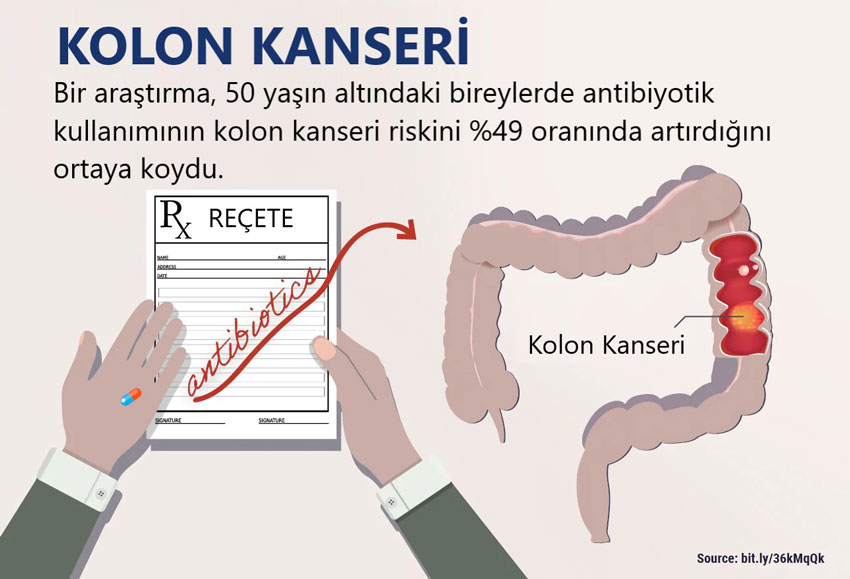 antibiyotiklere maruz kalmanin kolon rektum degil kanseri gelisimi ile iliskili olabilecegini goste