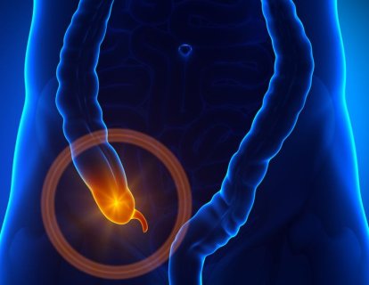 Apendiks kanseri nedir? Belirtileri ve tedavisi