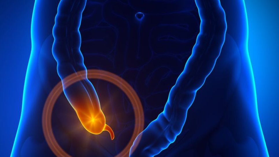 Apendiks kanseri nedir? Belirtileri ve tedavisi
