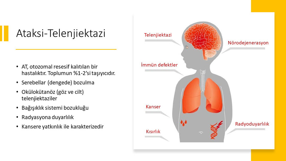 ataksi telenjiektazi nedir belirtileri nelerdir infografi gorsel 878713