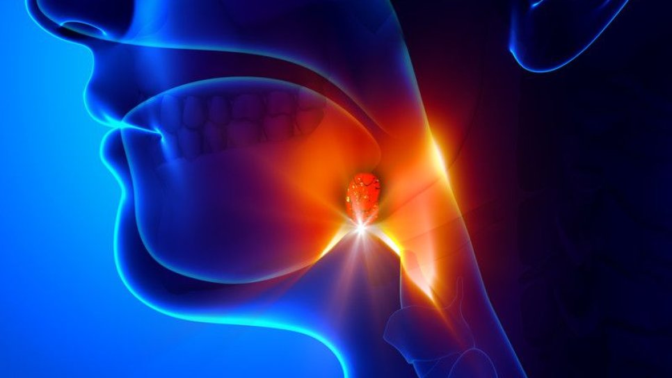 Bademcikte Kanser Nasıl Oluşur? Bademcik (Tonsil) Kanseri Belirtileri ve Tedavisi