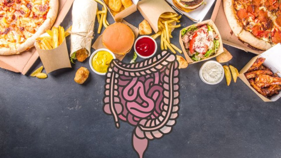 Cum provoacă alimentația occidentală cancer de colon și rect? O nouă perspectivă