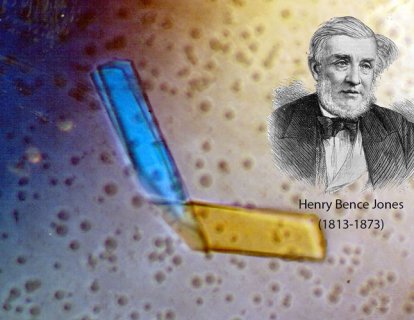 Bence-Jones Proteini Nedir? İsmi Nereden Gelmektedir?