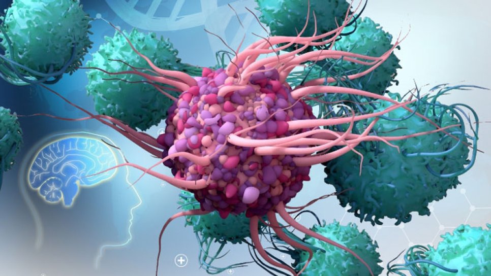 Mit Tumorzellen hergestellter dendritischer Zellimpfstoff gegen den Hirntumor GBM