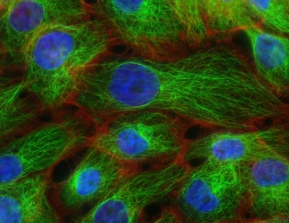 Biyolojik olarak farklı Nöroendokrin Tümörlerin tanısı ve güncel tedavisi