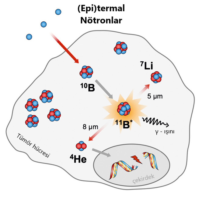 Bor-Neutroneneinfangtherapie BNYT