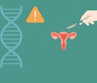 BRCA Dışı Kalıtsal Genetik Mutasyonlarda Risk Azaltıcı Ameliyat Gerekli mi?