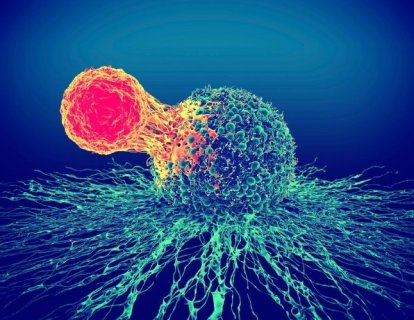 Büyük B Hücreli Lenfoma İkinci Basamak Tedavisi için Breyanzi FDA Onayı Aldı