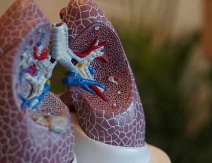 Büyük hücreli karsinom nedir? Bilmeniz gerekenler