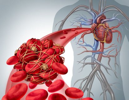 Trombotik trombositopenik purpura (TTP) tedavisi için caplacizumab FDA onayı aldı
