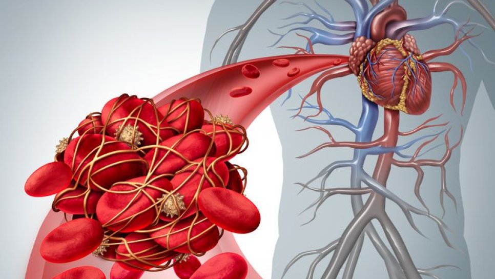 Trombotik trombositopenik purpura (TTP) tedavisi için caplacizumab FDA onayı aldı